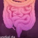 A Doença Inflamatória Intestinal tem como principais sintomas: diarreia grave, d…