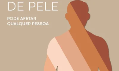 Proteger-se do sol é fundamental para prevenir doenças de pele. Aplique protetor…