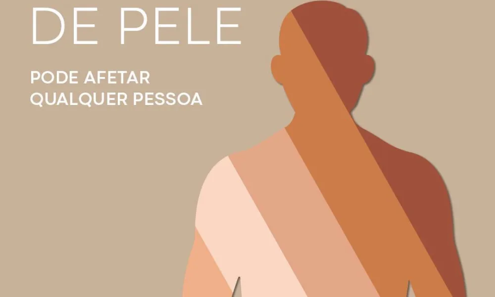 Proteger-se do sol é fundamental para prevenir doenças de pele. Aplique protetor…