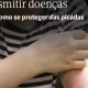 Com o tempo quente e no verão, proteja-se das picadas frequentes de mosquitos. A…