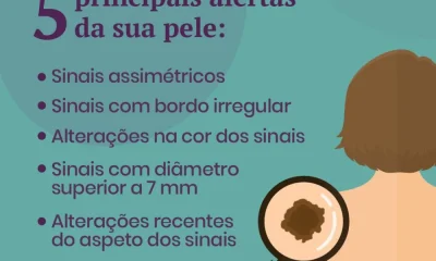 O melanoma é um tipo de cancro da pele que surge, com mais frequência, a partir …