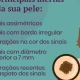 O melanoma é um tipo de cancro da pele que surge, com mais frequência, a partir …